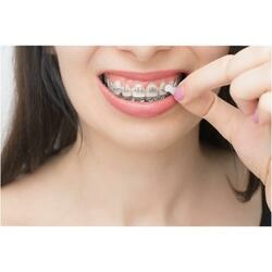 Abbildung klein von Gum Orthodontisches Wachs